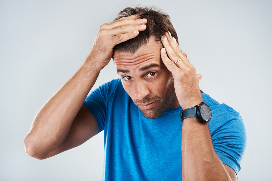 Topical Vs Oral Finasteride