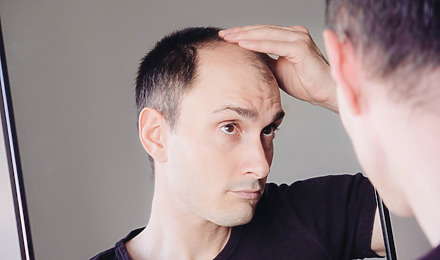 Can Hair Grow Back After Balding Naturally
