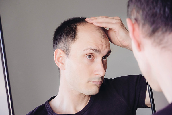 Can Hair Grow Back After Balding Naturally