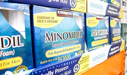 Minoxidil Foam Uses