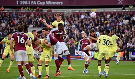 Hair transplant blog, Wimpole Clinic