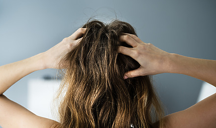 Scabs On Scalp