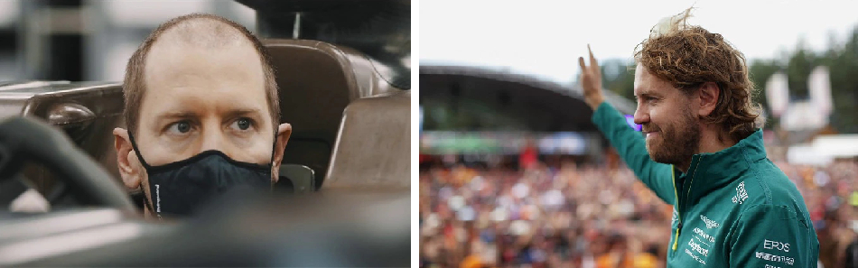 Sebastian Vettel before and after rumoured hair transplant