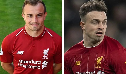 Xherdan Shaqiri Hair Transplant: Everything You Need To Know