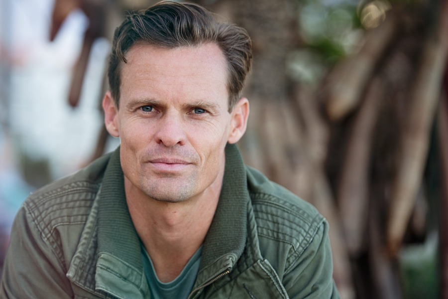 Where Does Hair Transplant Hair Come From Featured Image