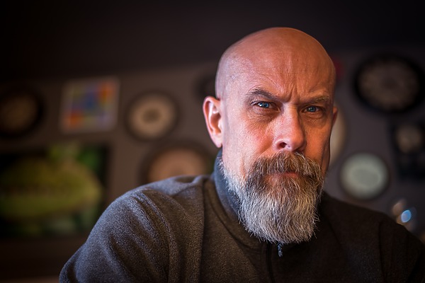 Types Of Alopecia: Causes, Symptoms, Treatments