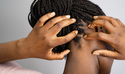 Why Is My Scalp Tender In One Spot Featured Image